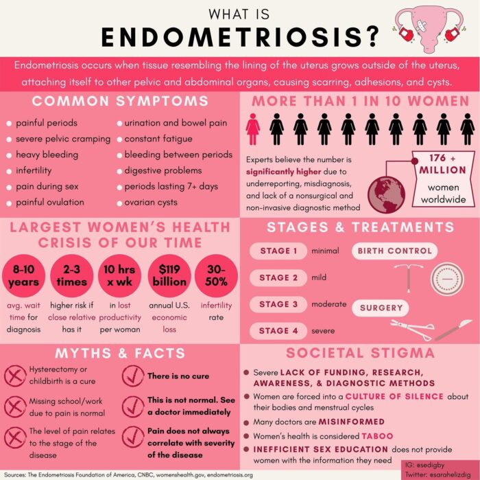 Do I Have Endometriosis? Signs and symptoms